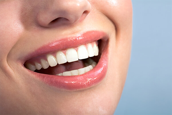 smile after Dental Crowns